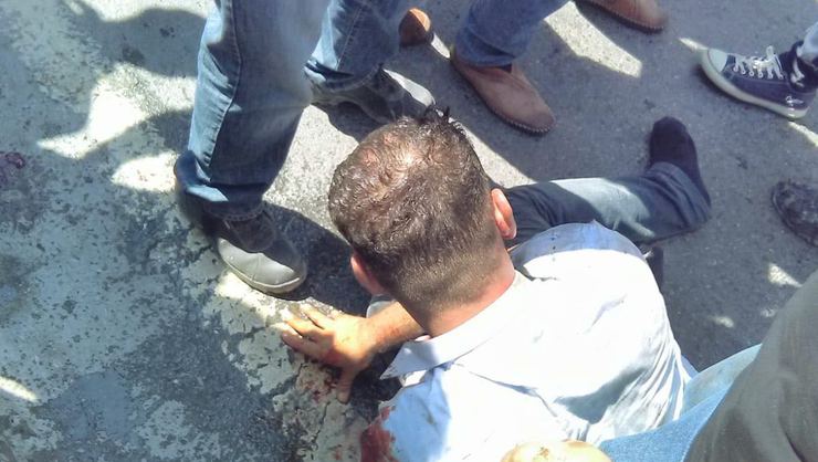 Çocuğunun kafasını demir bariyerlere vurdu! İstanbul'da cani babaya linç girişimi