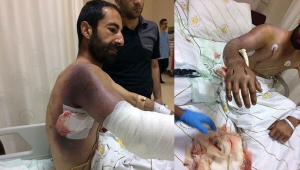 Taşla yaraladığı yılan ısırdı, hayati tehlikesi var