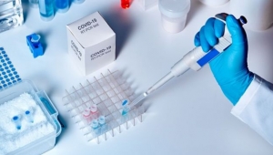Bedava olan testi 1250 TL'ye yapıyorlar