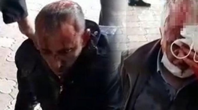 Tarlaya hayvanlar girdi kavga çıktı Kavgada, 3'ü ağır, 7 kişi yaralandı..