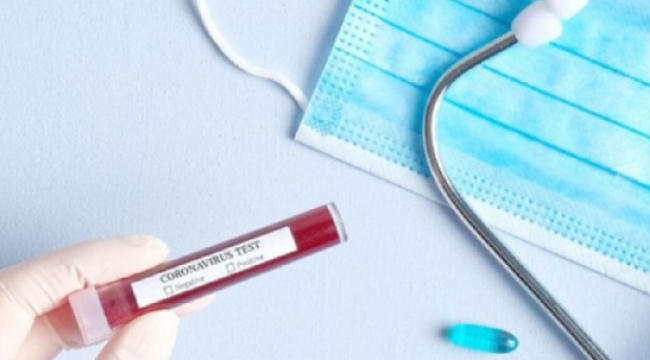 Koronavirüs testi için yaptırım geliyor