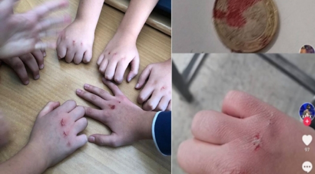 Bulaşıcı hastalıklara davetiye çıkarıyor! Son günlerde hızla yayılan 'kanlı para' oyunu nedir?