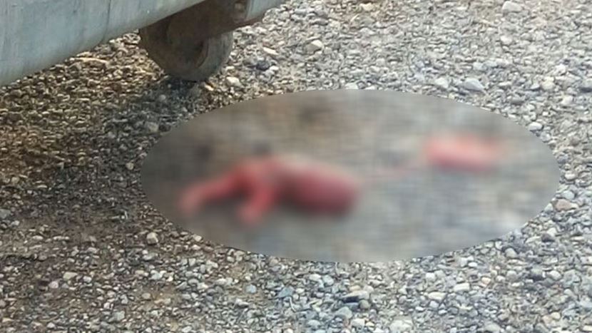 Şüpheli paketten 5 aylık cenin çıktı
